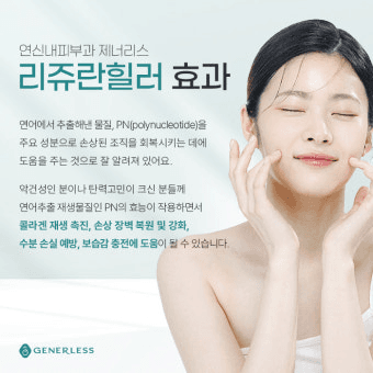 리쥬란 힐러 전후 사진